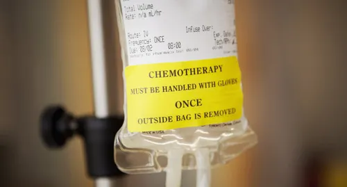 chemotherapy IV bag