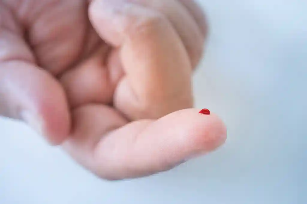 blood sugar fingertip prick