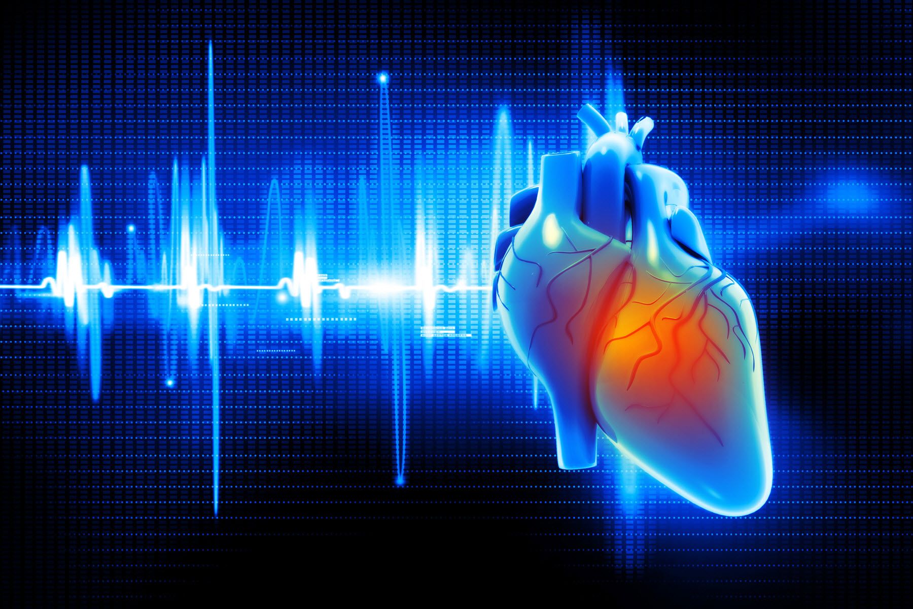 Will You Have Cardiac Arrest? New Tech May Predict If and When