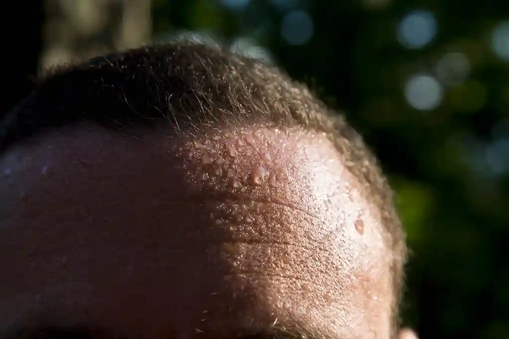 photo of man with sweaty forehead