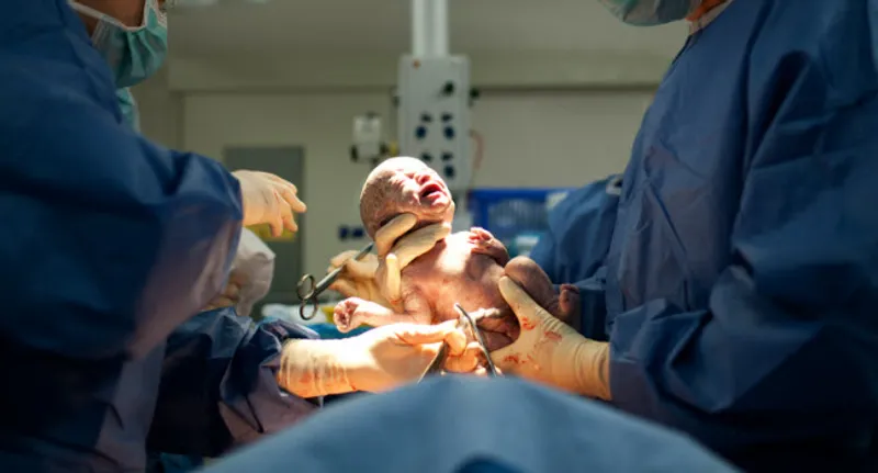 650x350_c-section