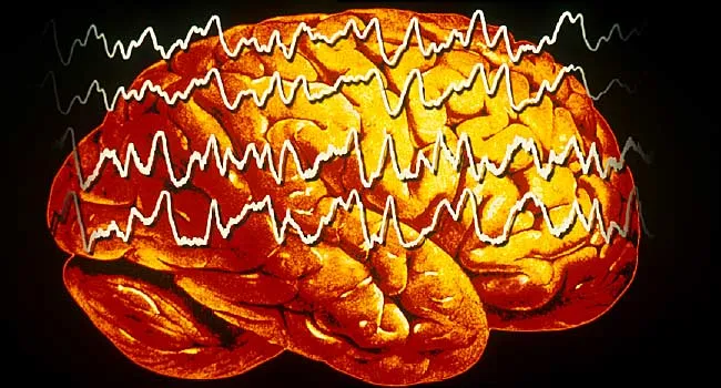 eeg of brain during seizure