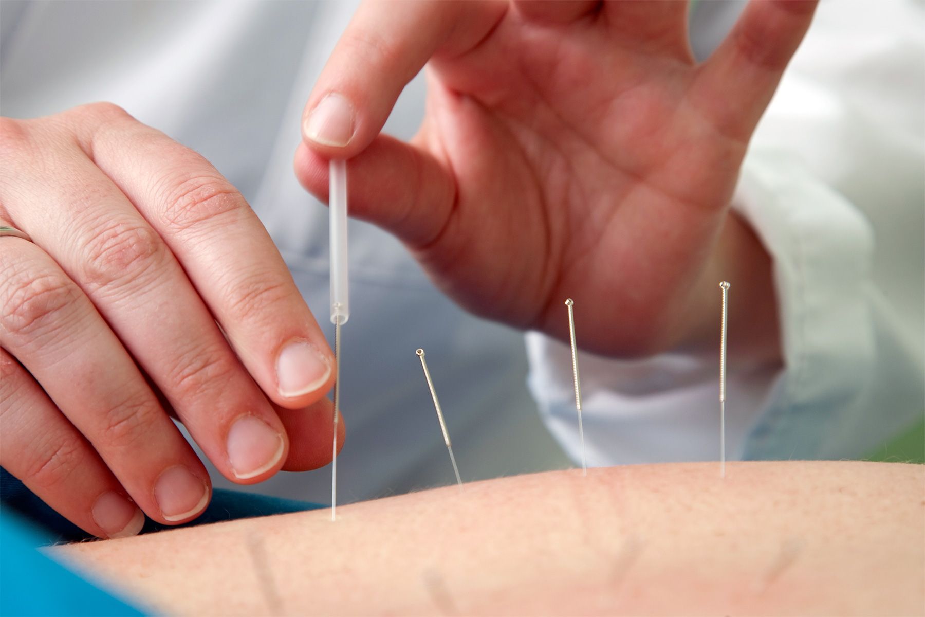 Acupuncture On Point for COVID stress Relief