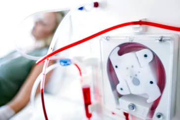 Using a Dialysis Machine for Your Health
