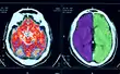 CT scan images of human brain