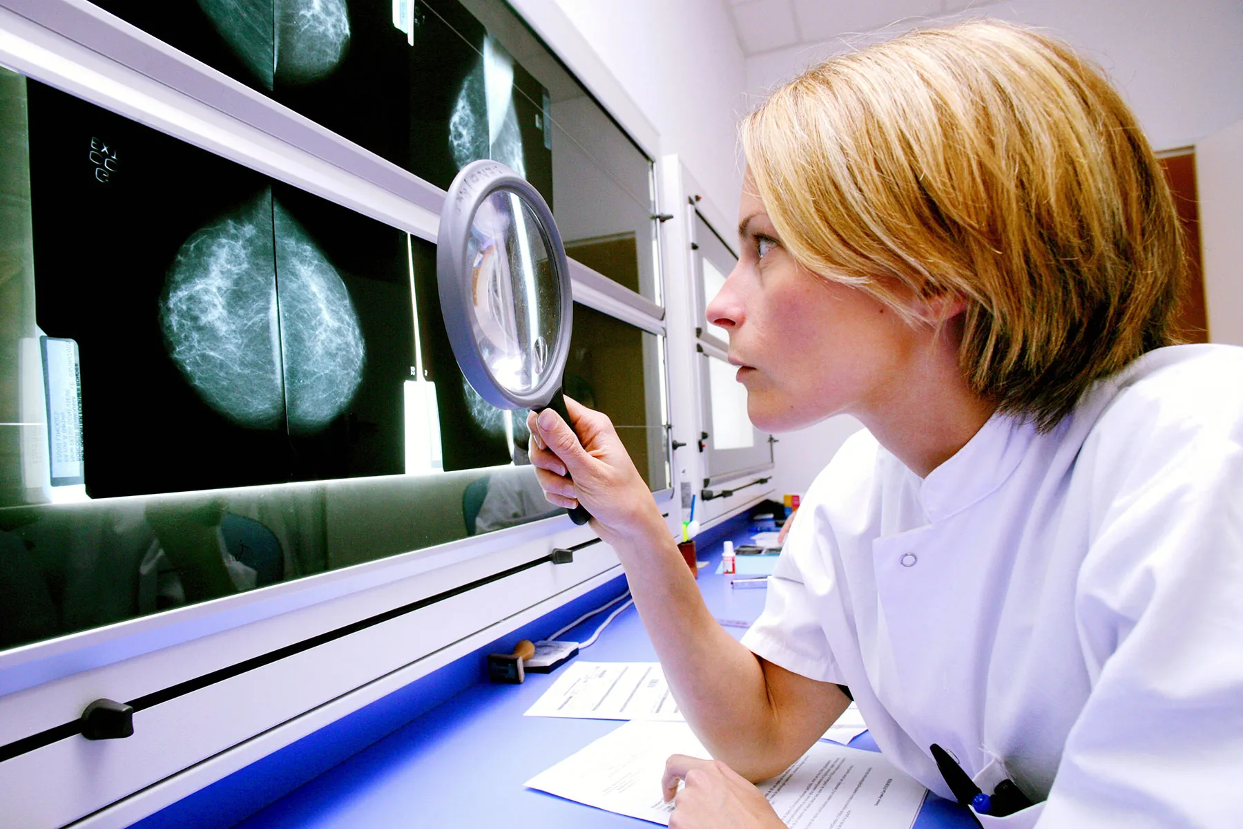Despite Scares from COVID Vaccine, Mammograms Still Vital