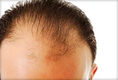 12 signs of hair loss to bring up to your dermatologist - GMA