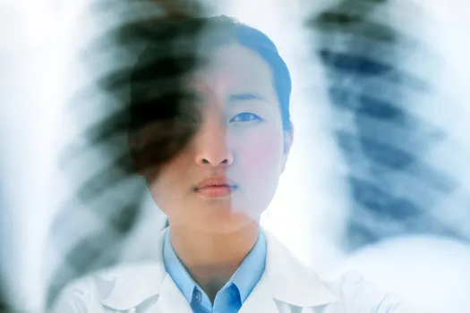 doctor holding up lung xray