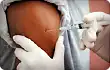nurse administering flu vaccine