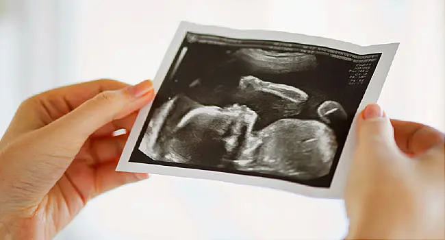 woman holding ultrasound image
