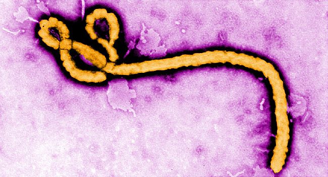 Image result for ebola virus"
