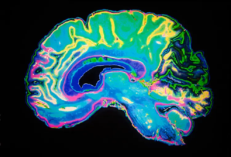 colorful brain image