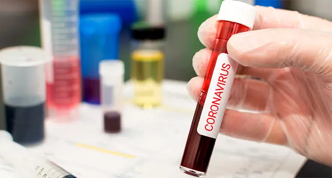 photo of blood vial