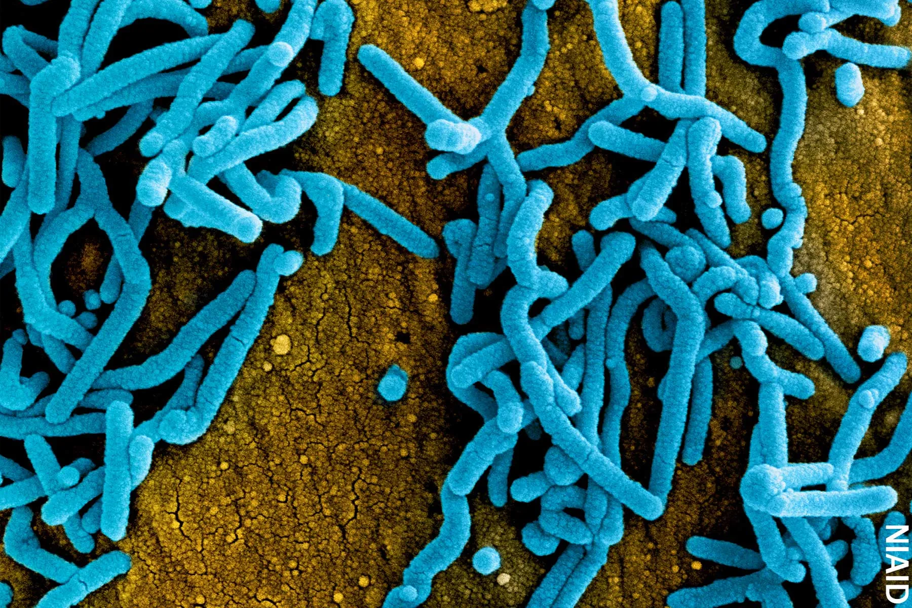 Death Reported From Ebola-Like Marburg Virus in West Africa