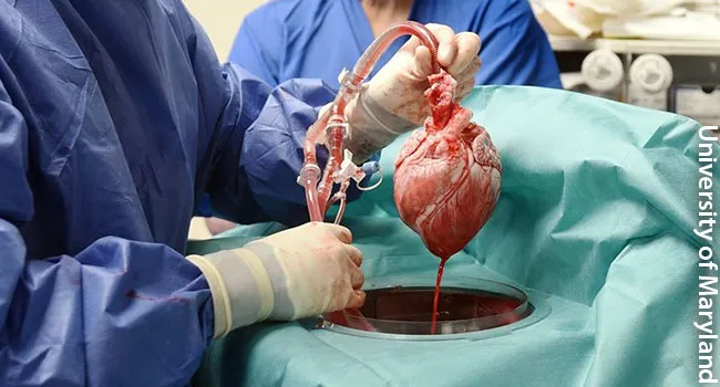 pig heart transplant