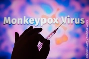 monkeypox virusmonkeypox virus