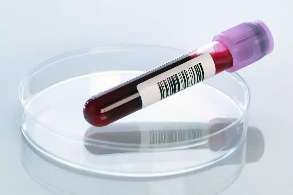 photo of blood sample in petri dish