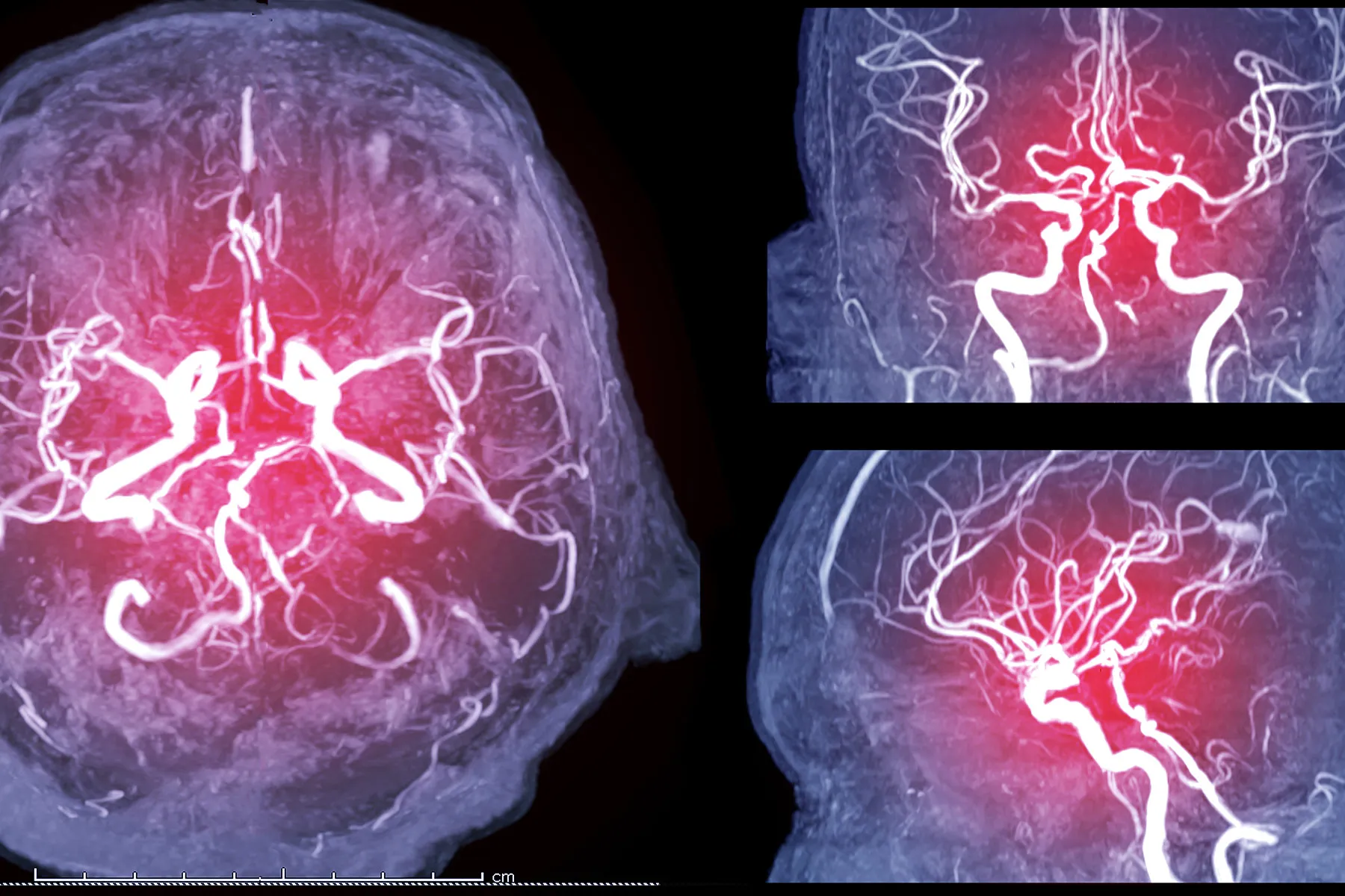 photo of medical illustration brain scan color