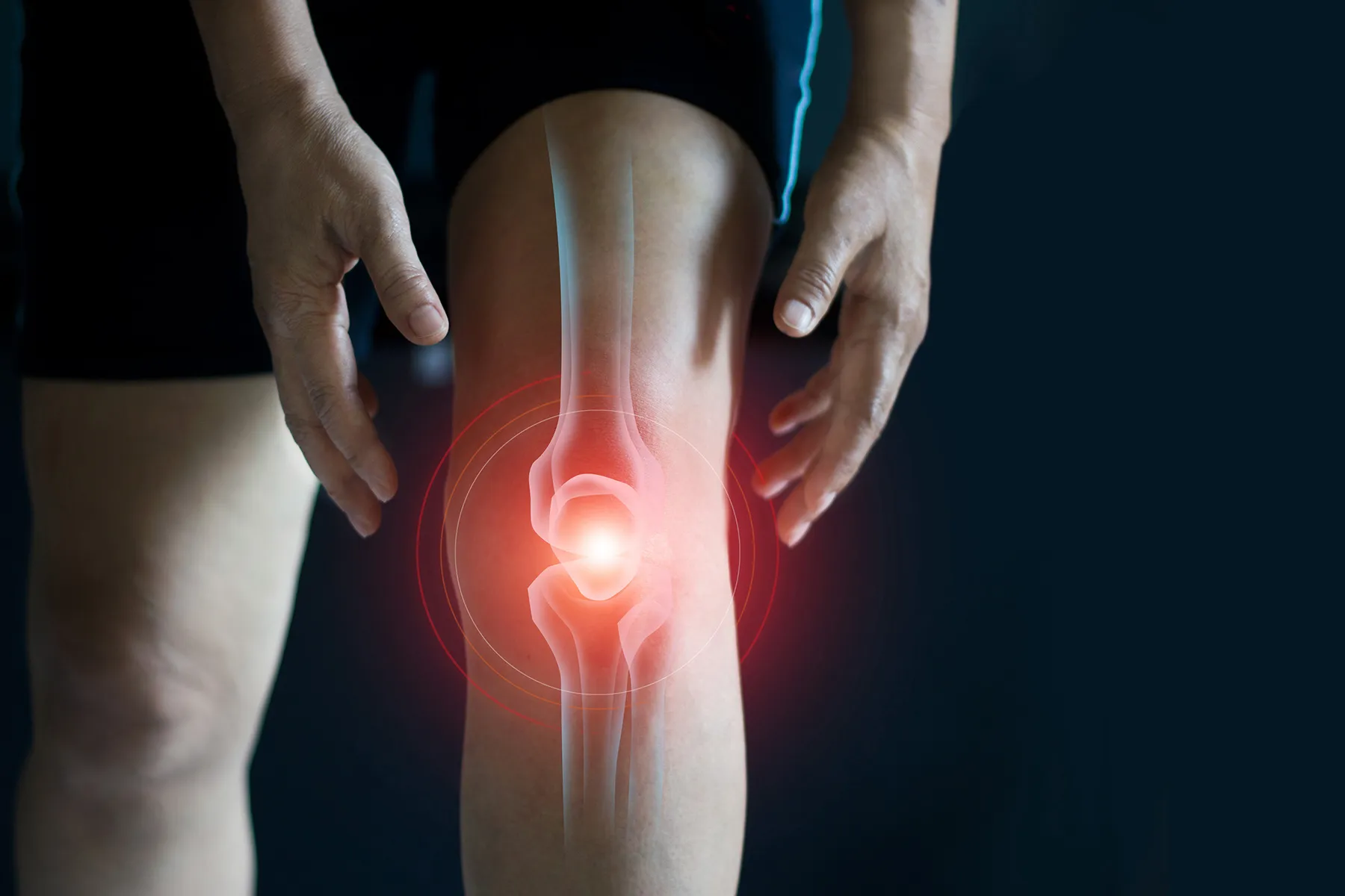 photo of  medical illustration knee pain man hurt