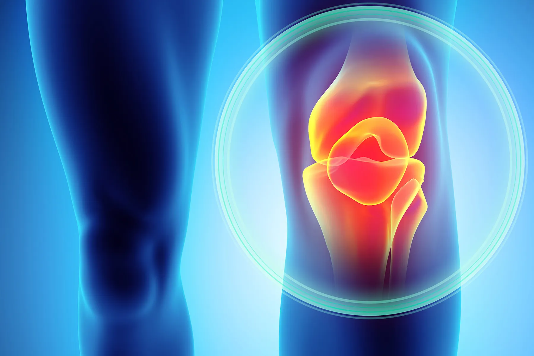 photo of medical illustration knee pain warm blue