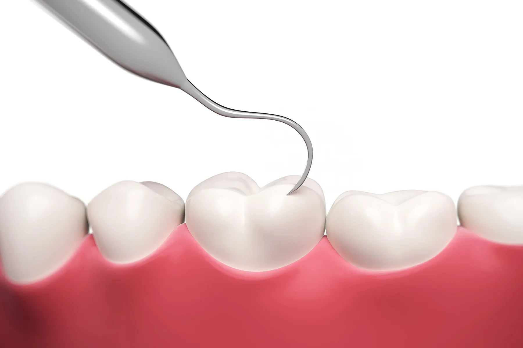 photo of medical illustration teeth hook dentist m