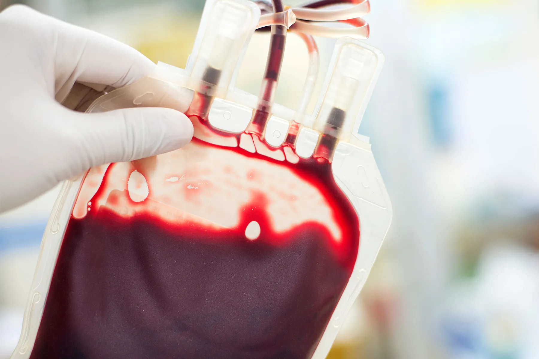 FDA Moves to Ease Restrictions on Gay Men Giving Blood 