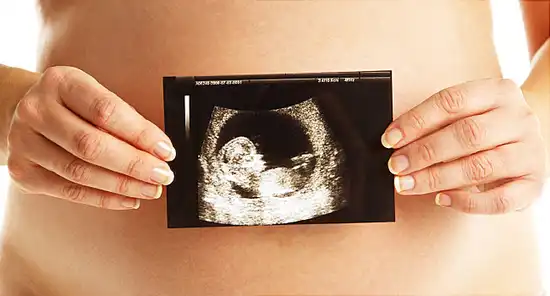 woman holding ultrasound scan