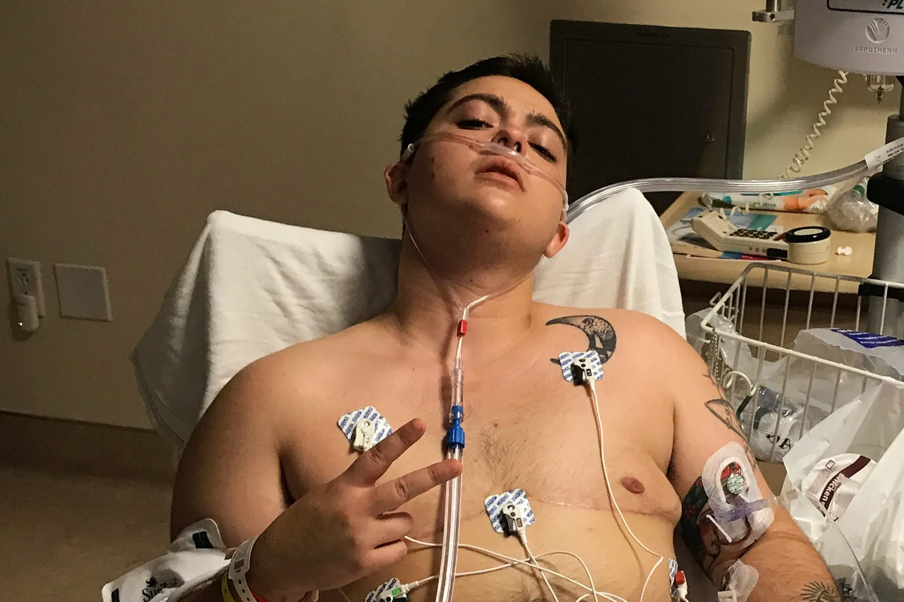 lincoln rennie vape patient in hospital