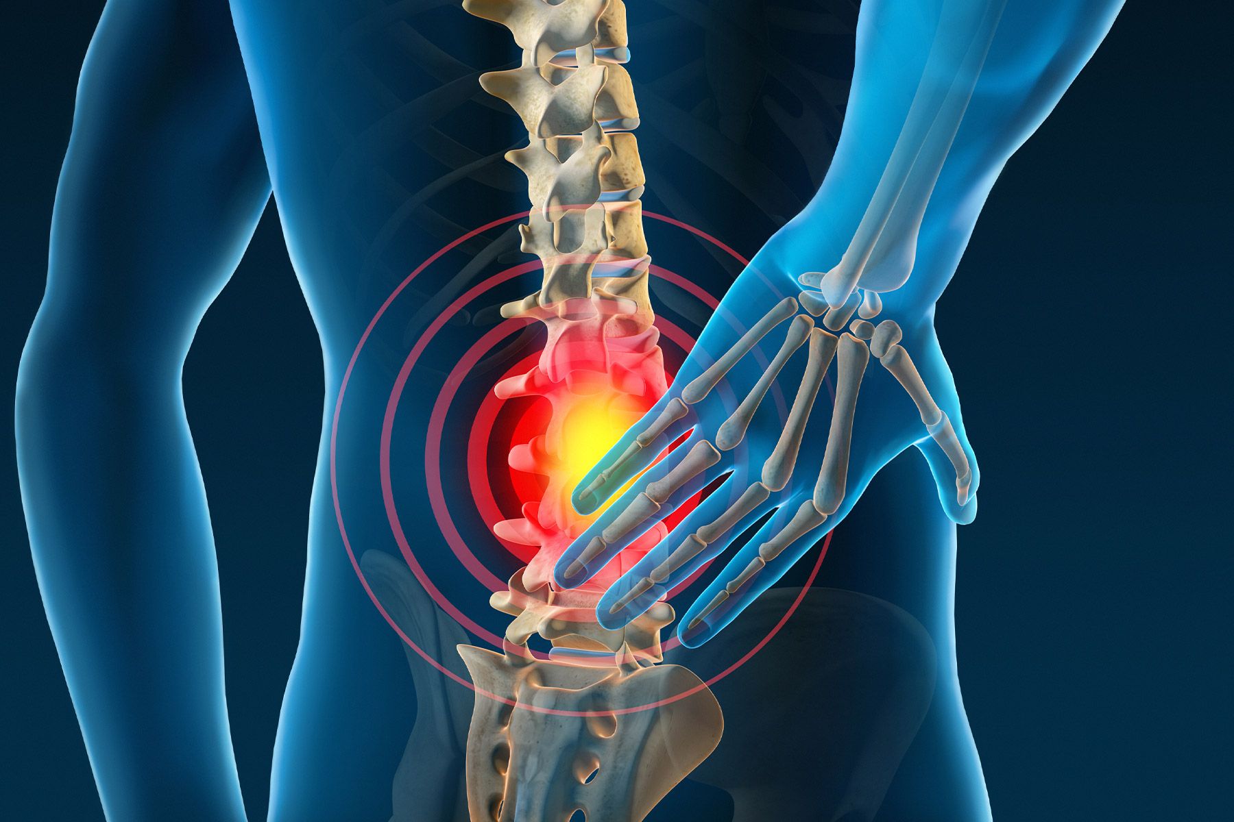How To Stop Back Pain From Taking Over Your Life