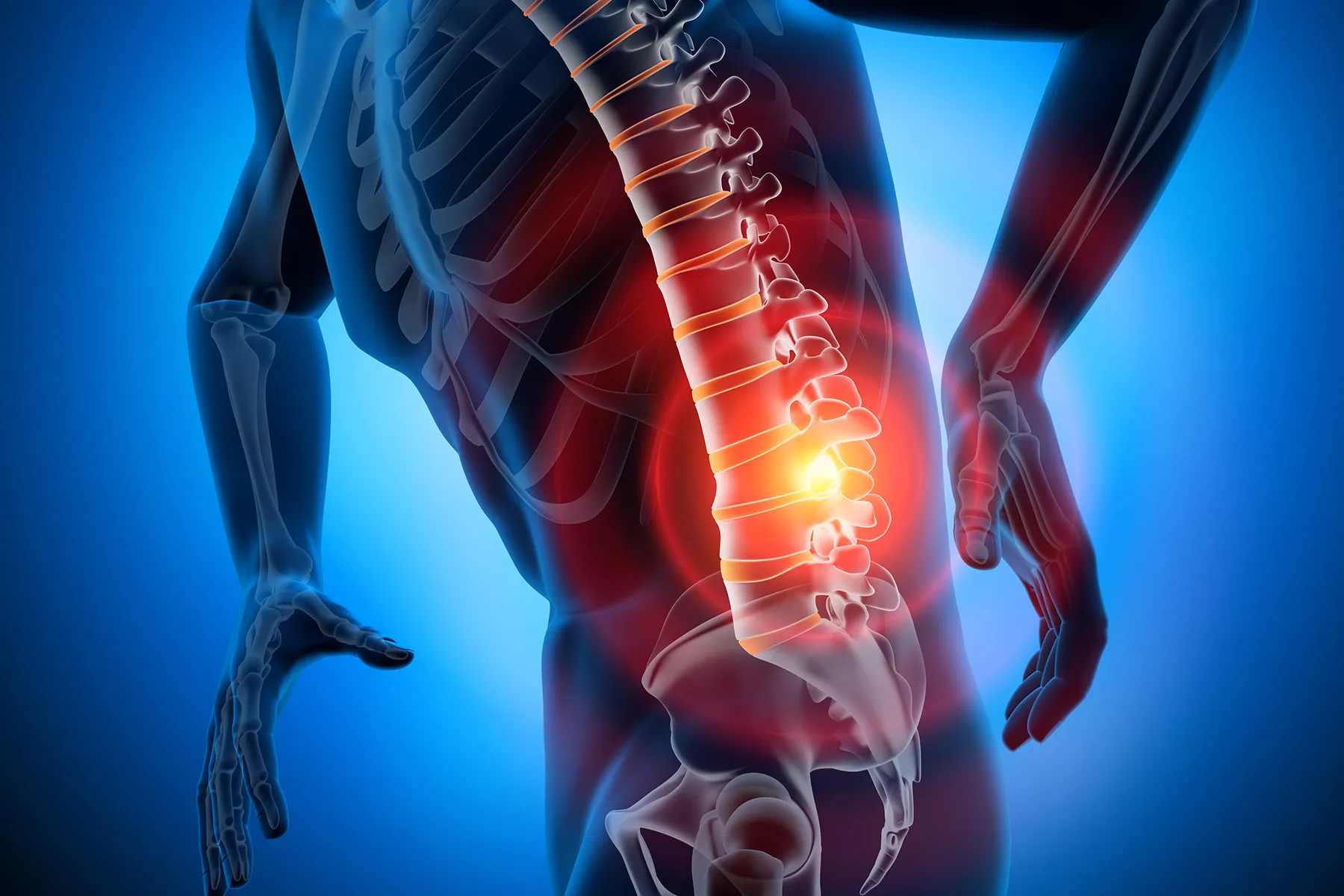 Injected ‘Hydrogel’ May Be New Option Against Back Pain