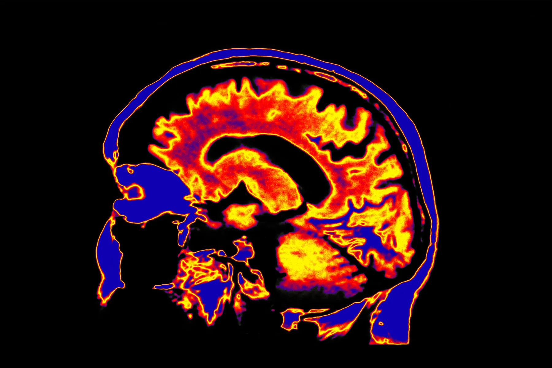 photo of medical illustration brain red orange bla