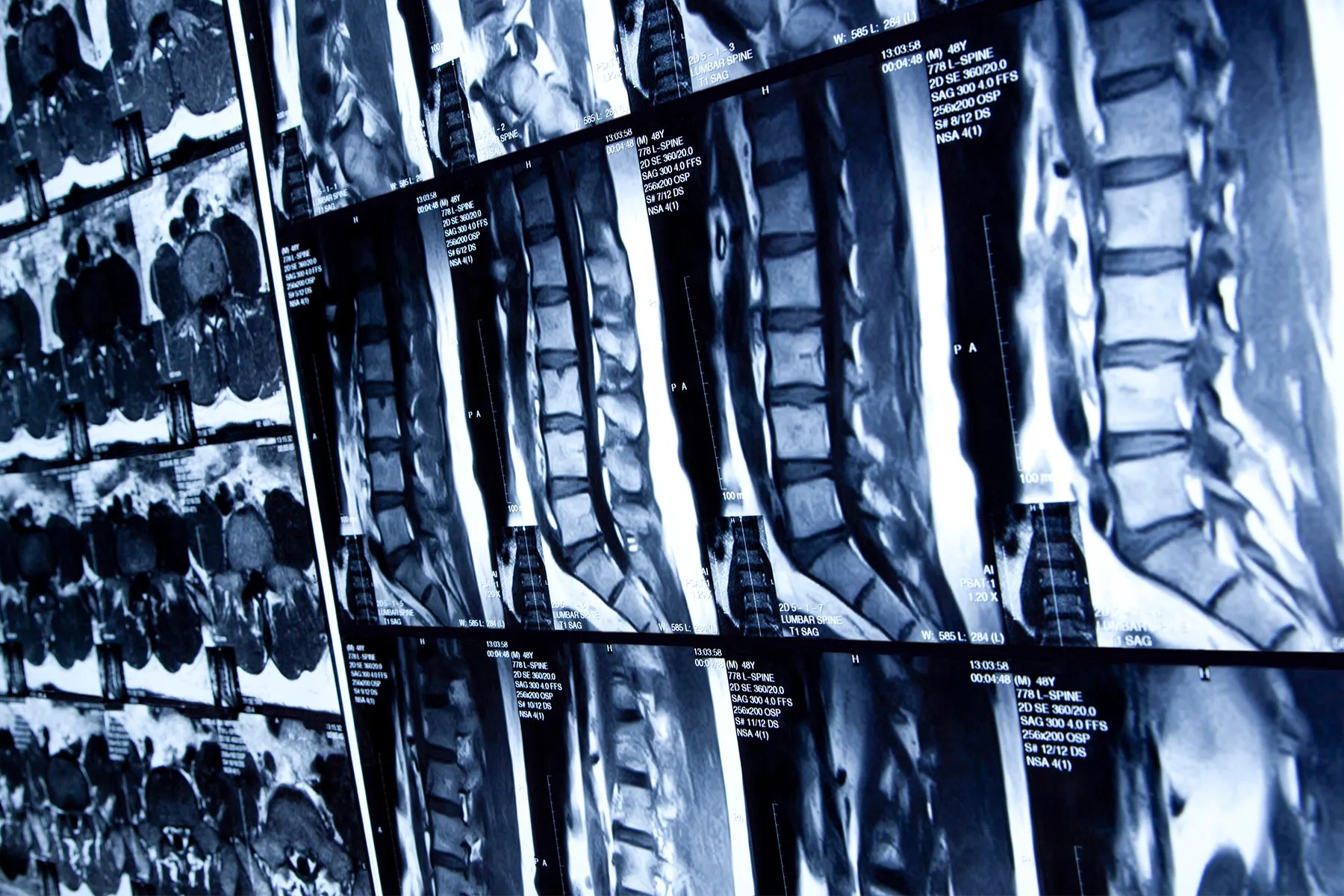 photo of medical photo scan spine bone neck