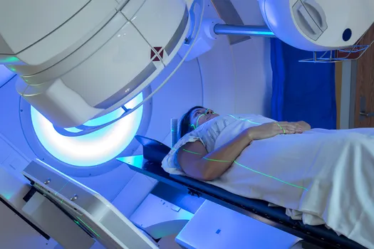 photo of radiation therapy for breast cancer