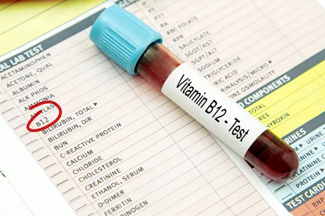 Vitamin B12 Deficiency Causes, Symptoms, and Treatment