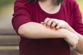 woman scratching her forearm