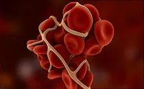 What To Know About Blood Clots