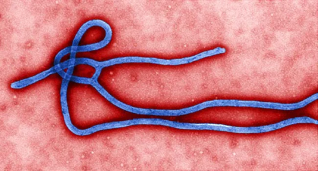 sem of ebola