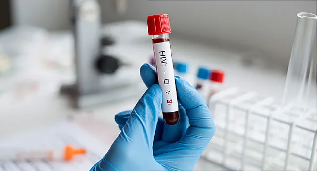 photo of hiv test