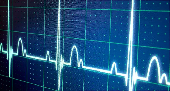 electrocardiogram readout
