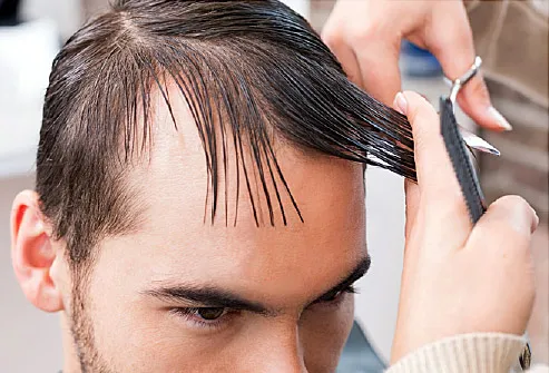 Men S Hair Loss Treatments And Solutions With Pictures