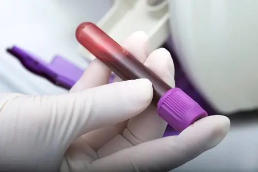 photo of blood test