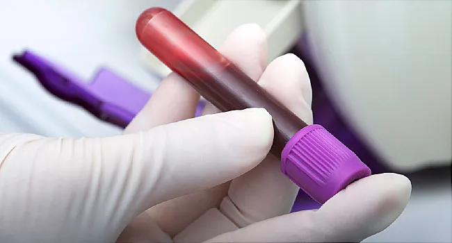 photo of blood test