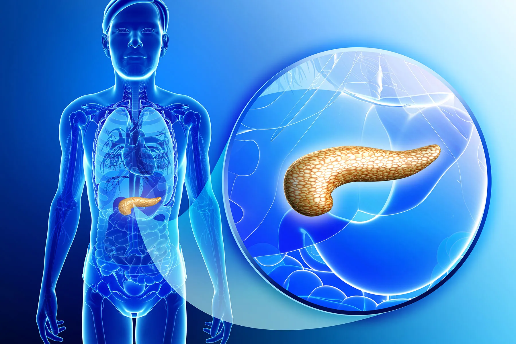 Exocrine Pancreatic Insufficiency: What It Is and Who’s at Risk