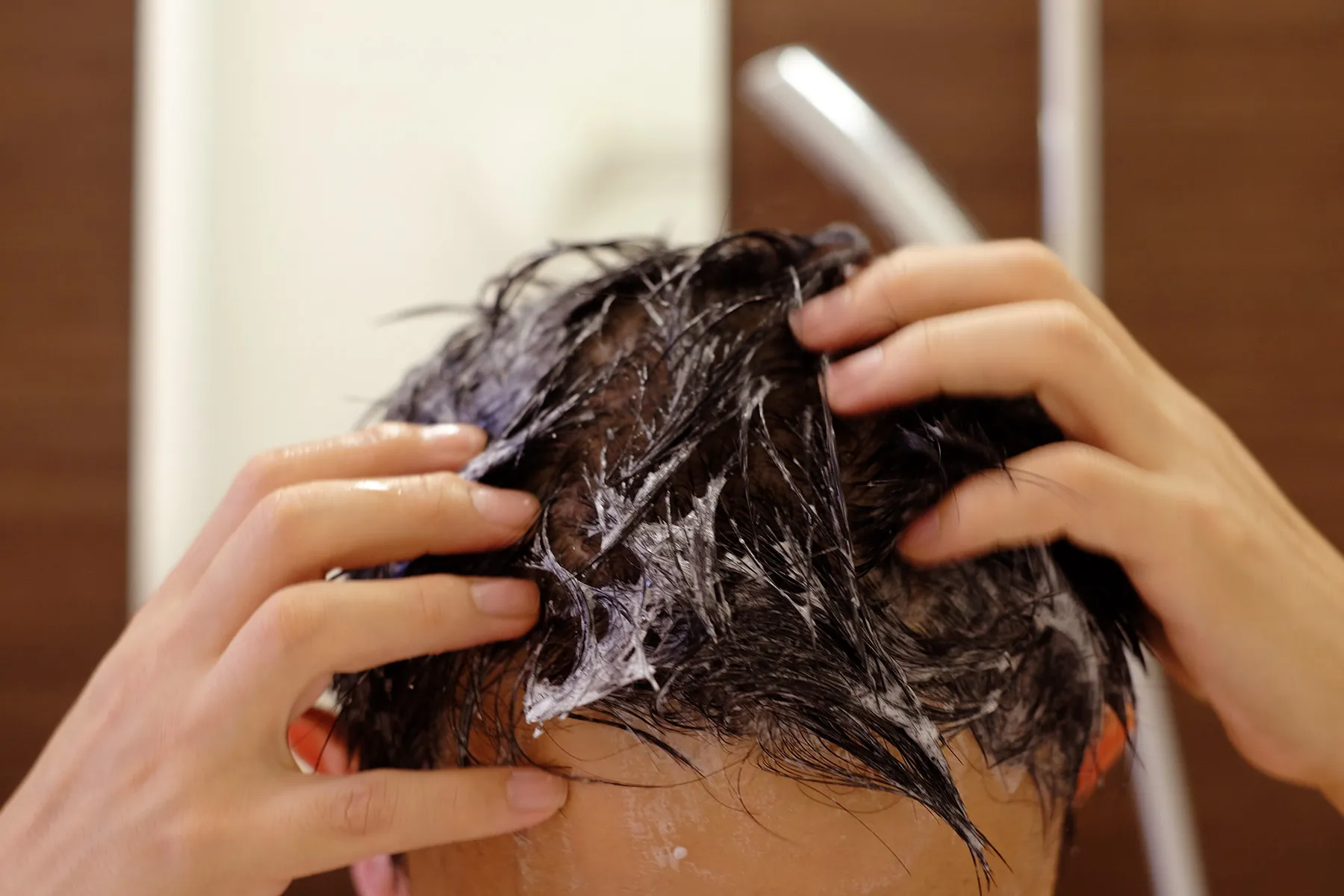 how to get psoriasis flakes out of hair Thai kenőcs pikkelysömörhöz