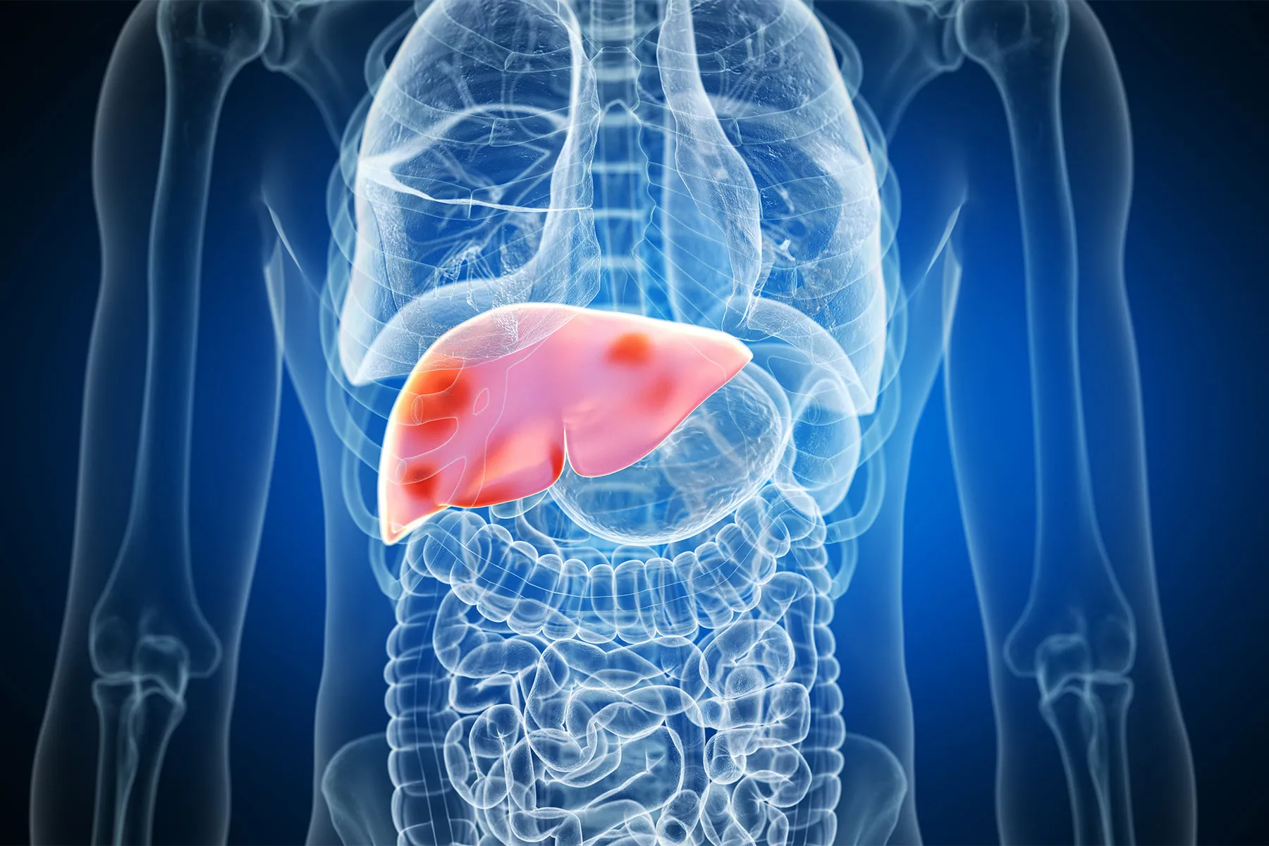 photo of liver