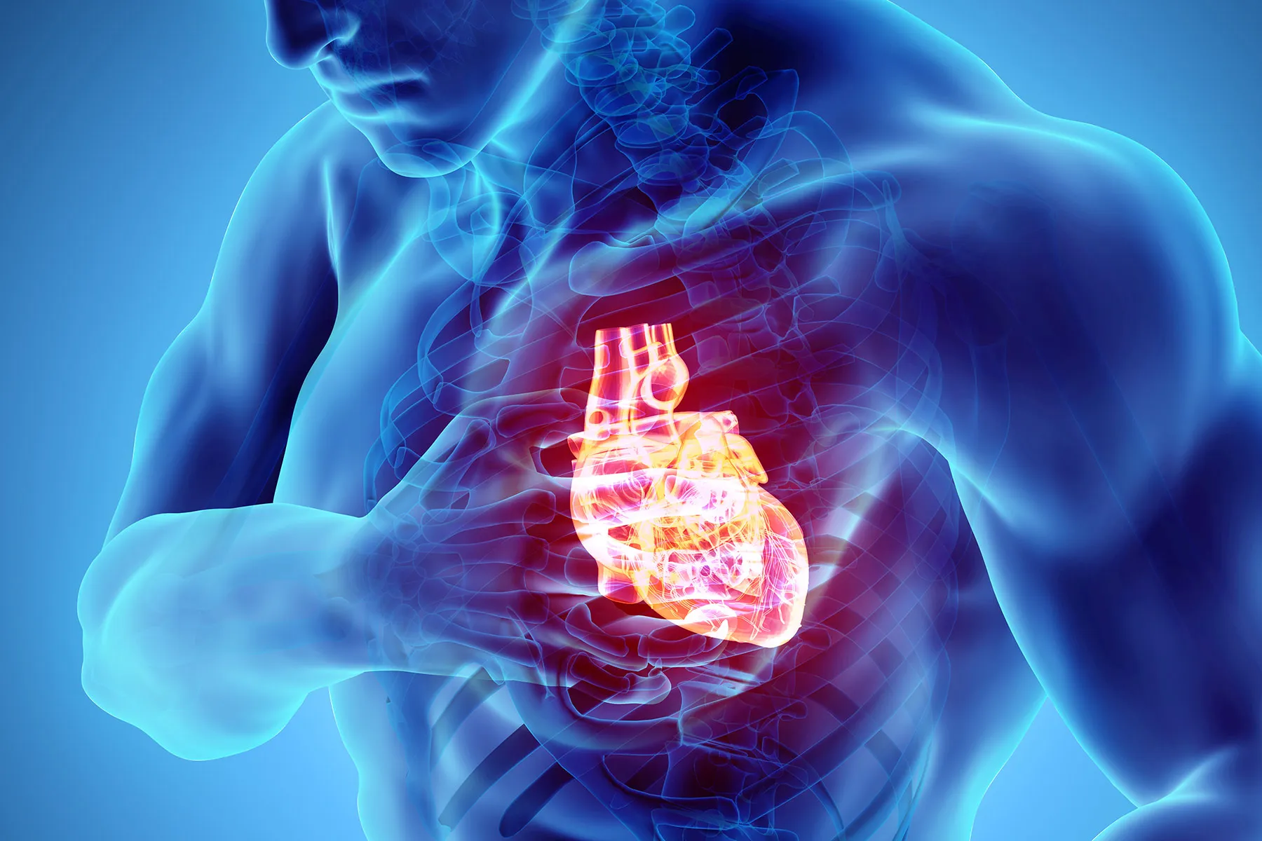 illustration of cardiac arrest