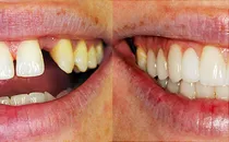 Image result for cosmetic dentistry
