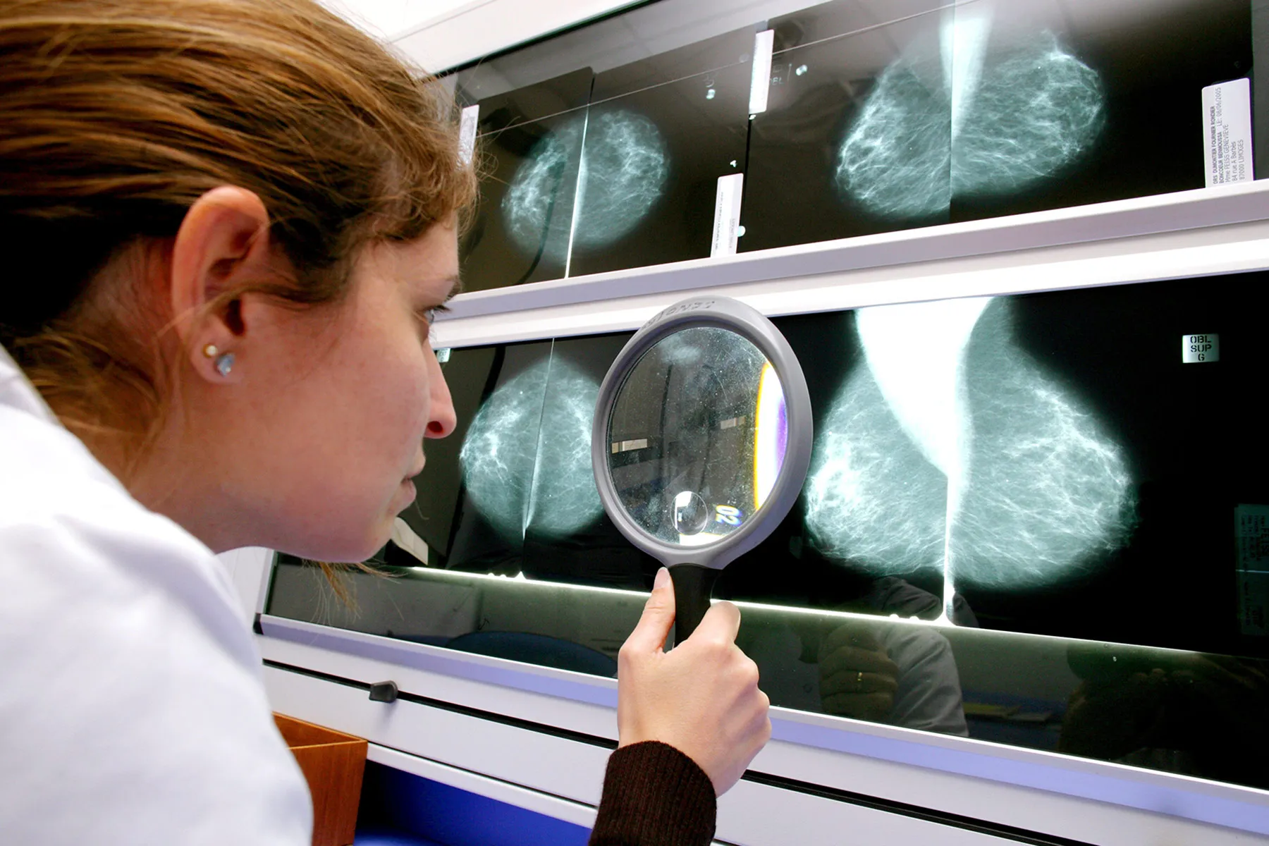 doctor examining mammogram