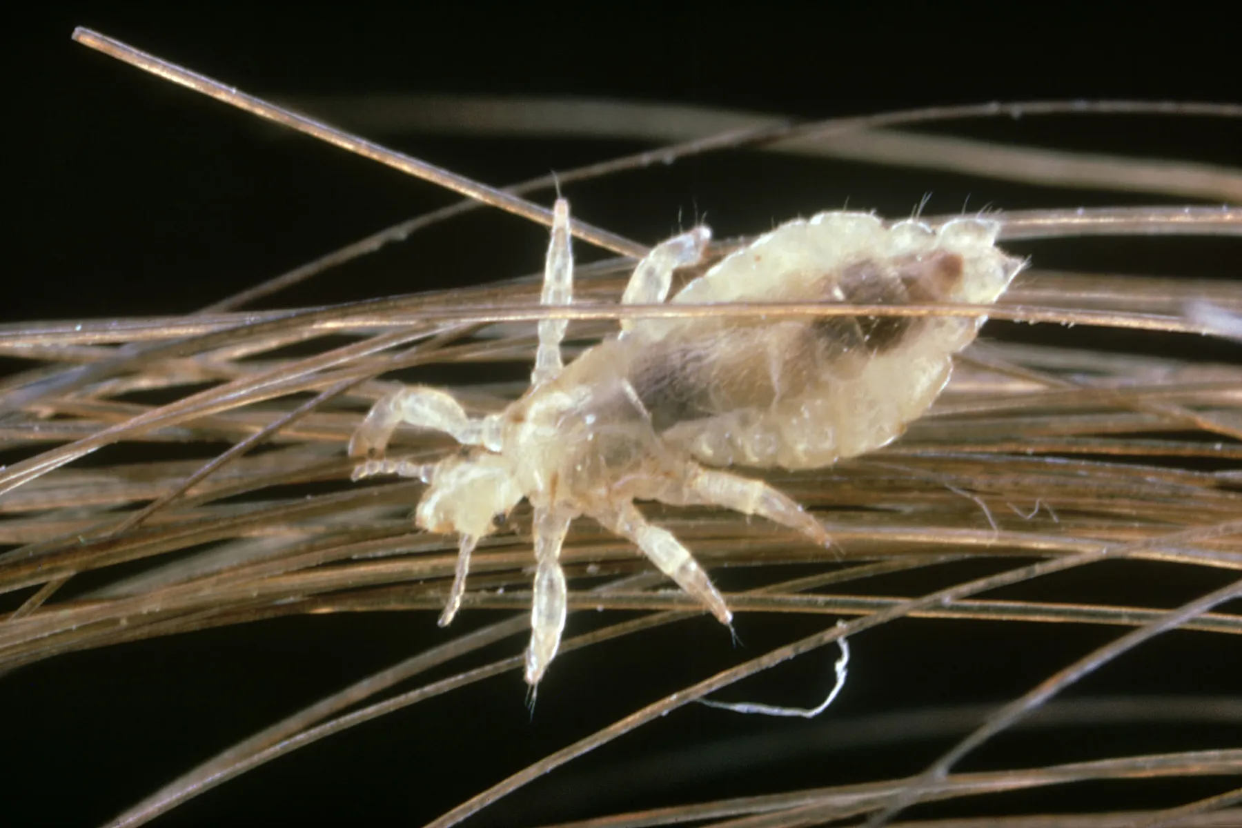 Lice: Pictures of What Head Lice Look Like