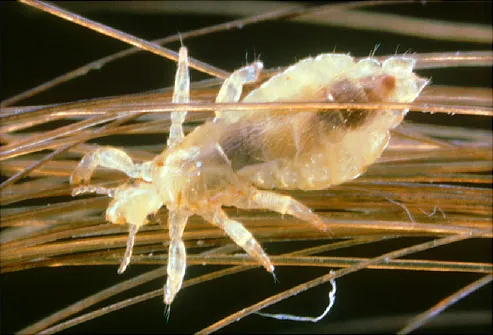 Lice Pictures Of What Head Lice Look Like